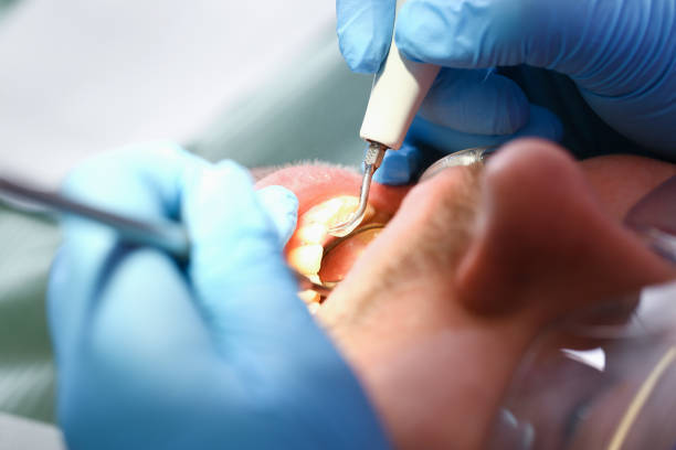 Best Emergency Tooth Extraction  in Licking, MO